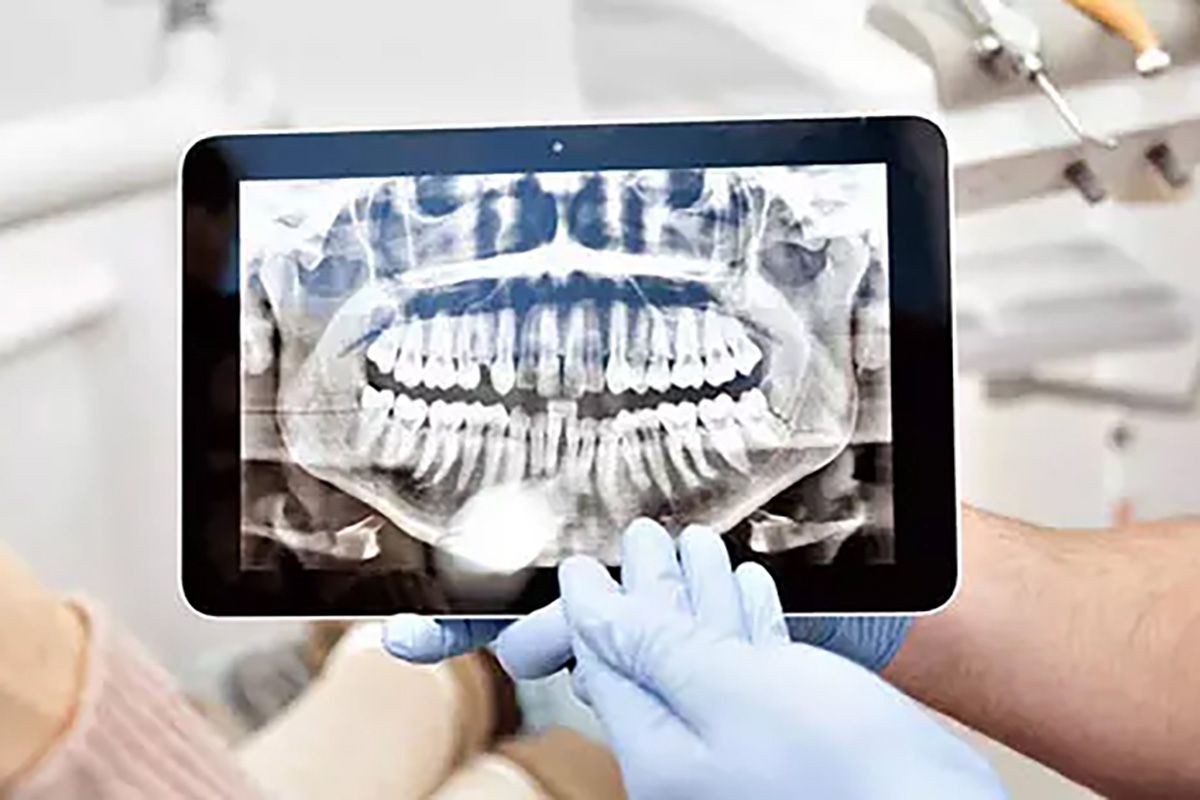 Dijital Tomografi ve Panoramik Röntgen