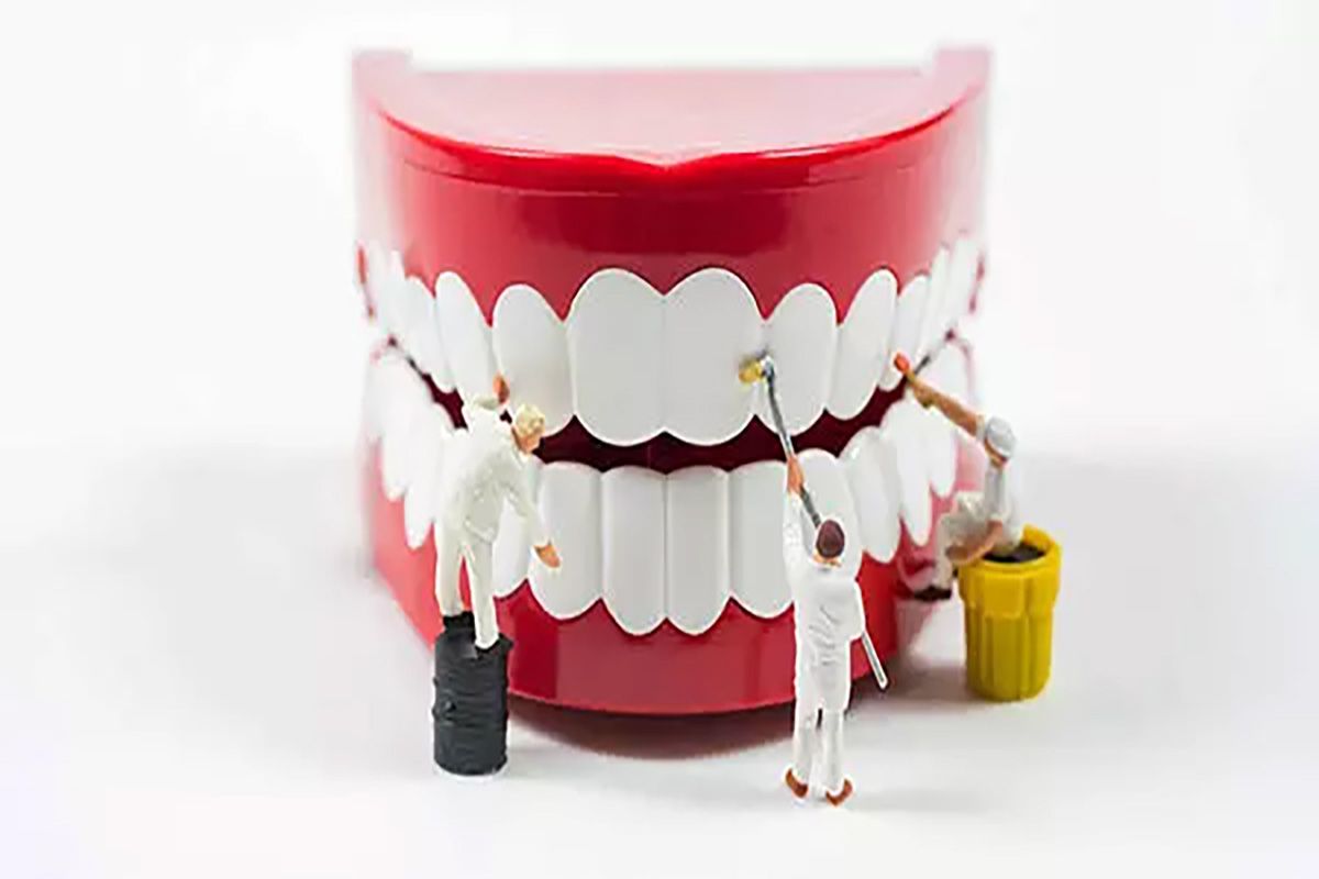 Diş Protezi Hizmeti