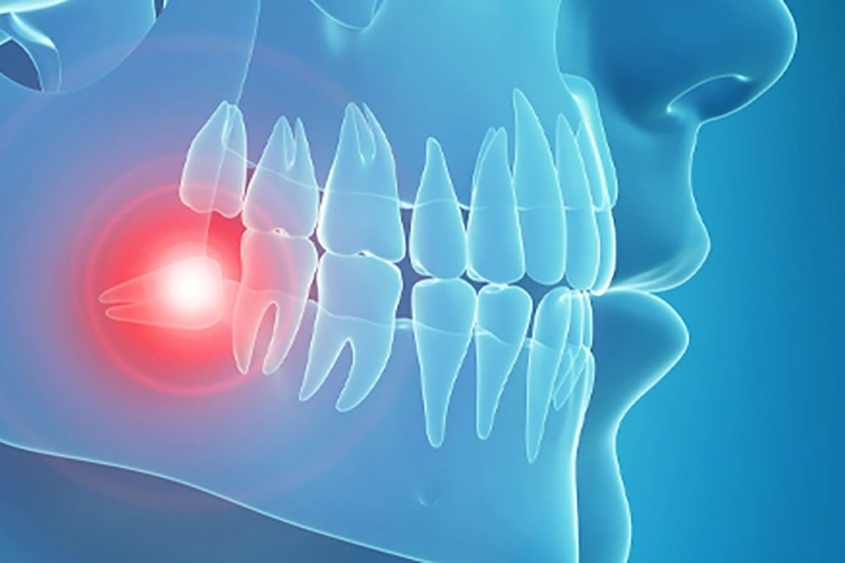 Ağız ve Çene Cerrahisi